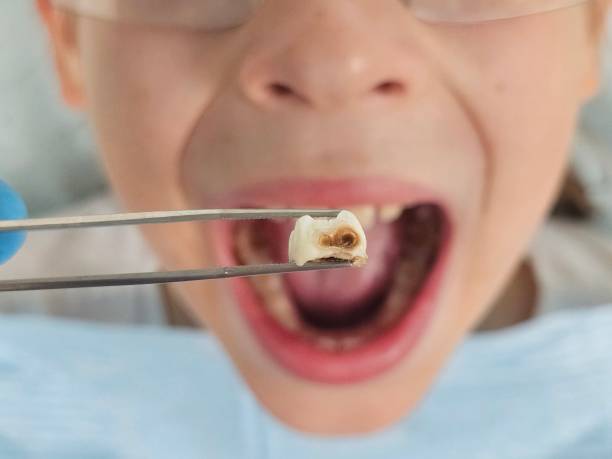 Best Same-Day Emergency Dental Services in Piney, AR