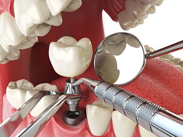 Best Emergency Treatment for Dental Infections or Abscesses in Piney, AR