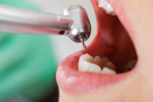 Best Emergency Dental Care for Broken or Chipped Teeth in Piney, AR